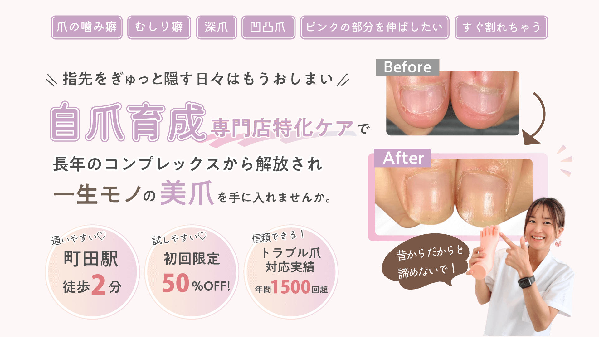 爪の噛み癖　むしり癖　深爪　凸凹爪　ピンクの部分を伸ばしたい　すぐ割れちゃう

＼ 指先をぎゅっと隠す日々はもうおしまい ／

自爪育成専門店特化ケアで

長年のコンプレックスから解放され
一生モノの美爪を手に入れませんか。


通いやすい♡
町田駅
徒歩2分

試しやすい♡
初回限定
50％OFF！

信頼できる！
トラブル爪対応実績
年間1500回超

昔からだからと諦めないで！
