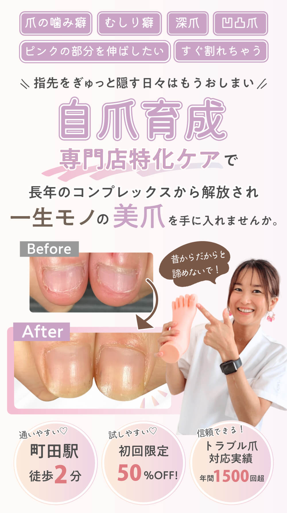 爪の噛み癖　むしり癖　深爪　凸凹爪　ピンクの部分を伸ばしたい　すぐ割れちゃう

＼ 指先をぎゅっと隠す日々はもうおしまい ／

自爪育成専門店特化ケアで

長年のコンプレックスから解放され
一生モノの美爪を手に入れませんか。


通いやすい♡
町田駅
徒歩2分

試しやすい♡
初回限定
50％OFF！

信頼できる！
トラブル爪対応実績
年間1500回超

昔からだからと諦めないで！