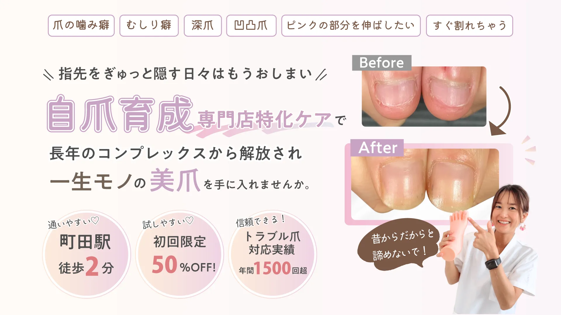 爪の噛み癖 むしり癖 深爪 凸凹爪 ピンクの部分を伸ばしたい すぐ割れちゃう
\ 指先をぎゅっと隠す日々はもうおしまい /
自爪育成専門店特化ケアで
長年のコンプレックスから解放され
一生モノの美爪を手に入れませんか。
通いやすい♡
町田駅
徒歩2分
試しやすい♡
初回限定
50%OFF!
信頼できる!
トラブル爪対応実績
年間1500回超
昔からだからと諦めないで!