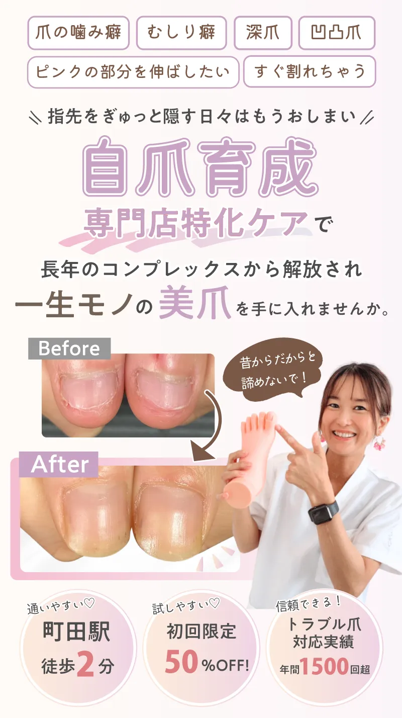 爪の噛み癖 むしり癖 深爪 凸凹爪 ピンクの部分を伸ばしたい すぐ割れちゃう
\ 指先をぎゅっと隠す日々はもうおしまい /
自爪育成専門店特化ケアで
長年のコンプレックスから解放され
一生モノの美爪を手に入れませんか。
通いやすい♡
町田駅
徒歩2分
試しやすい♡
初回限定
50%OFF!
信頼できる!
トラブル爪対応実績
年間1500回超
昔からだからと諦めないで!